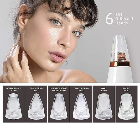 6 in 1 Blackhead Remover