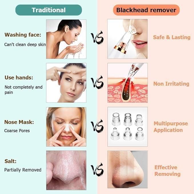 6 in 1 Blackhead Remover