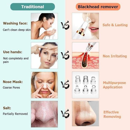 6 in 1 Blackhead Remover